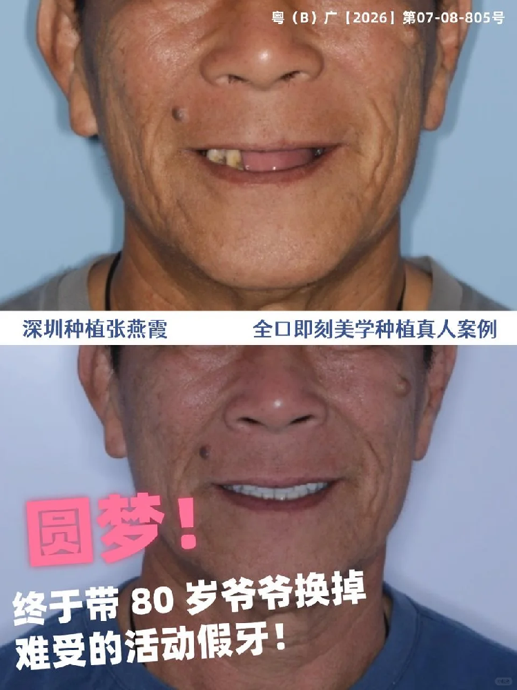 31a879b8d83f220910bd9c2409367f36.png