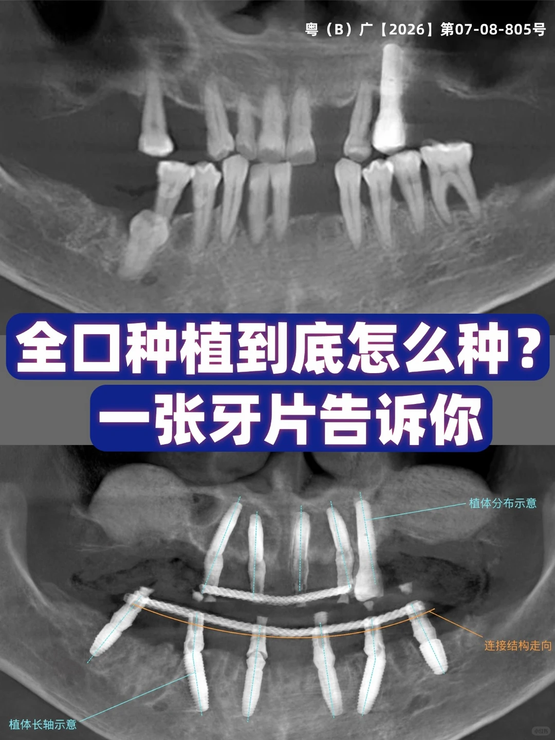 f0b7b238-1771-4205-a094-aaaa599a710e.png