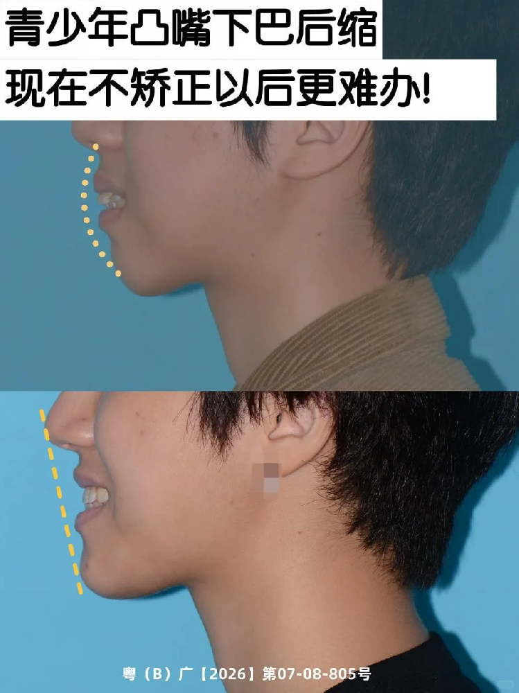 454d1caf-ef64-4839-8e34-2921e697c34a.png