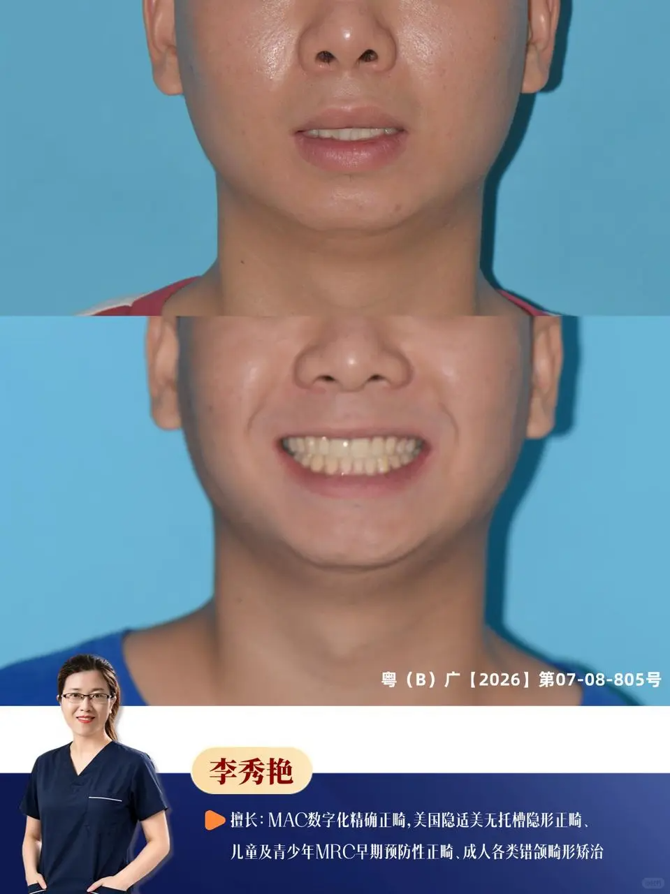 2dd12497-de64-4a36-a92d-12ea1c4cac26.png