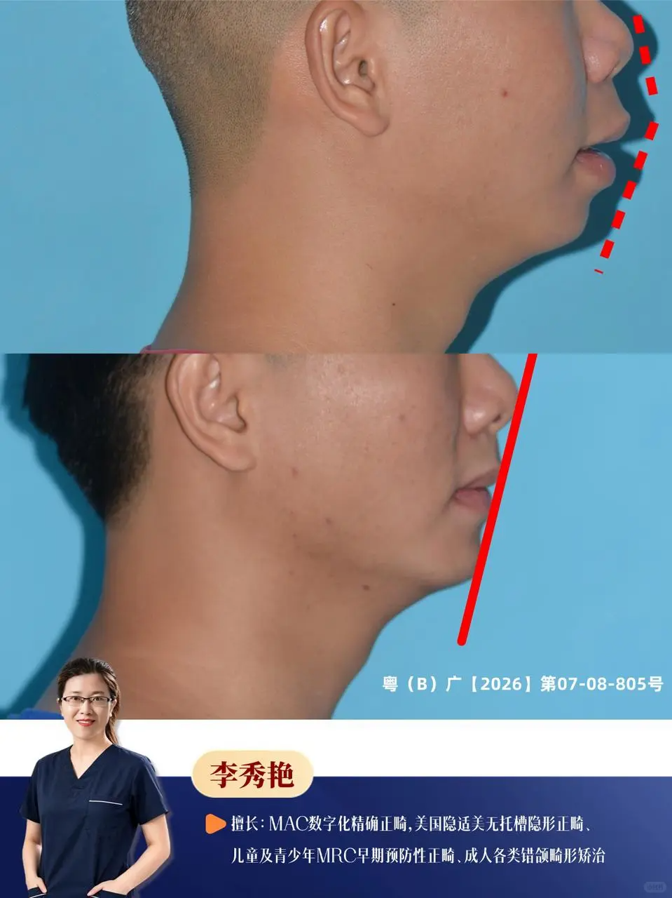 06a871d0-8087-4102-95b7-0d522bd154a1.png