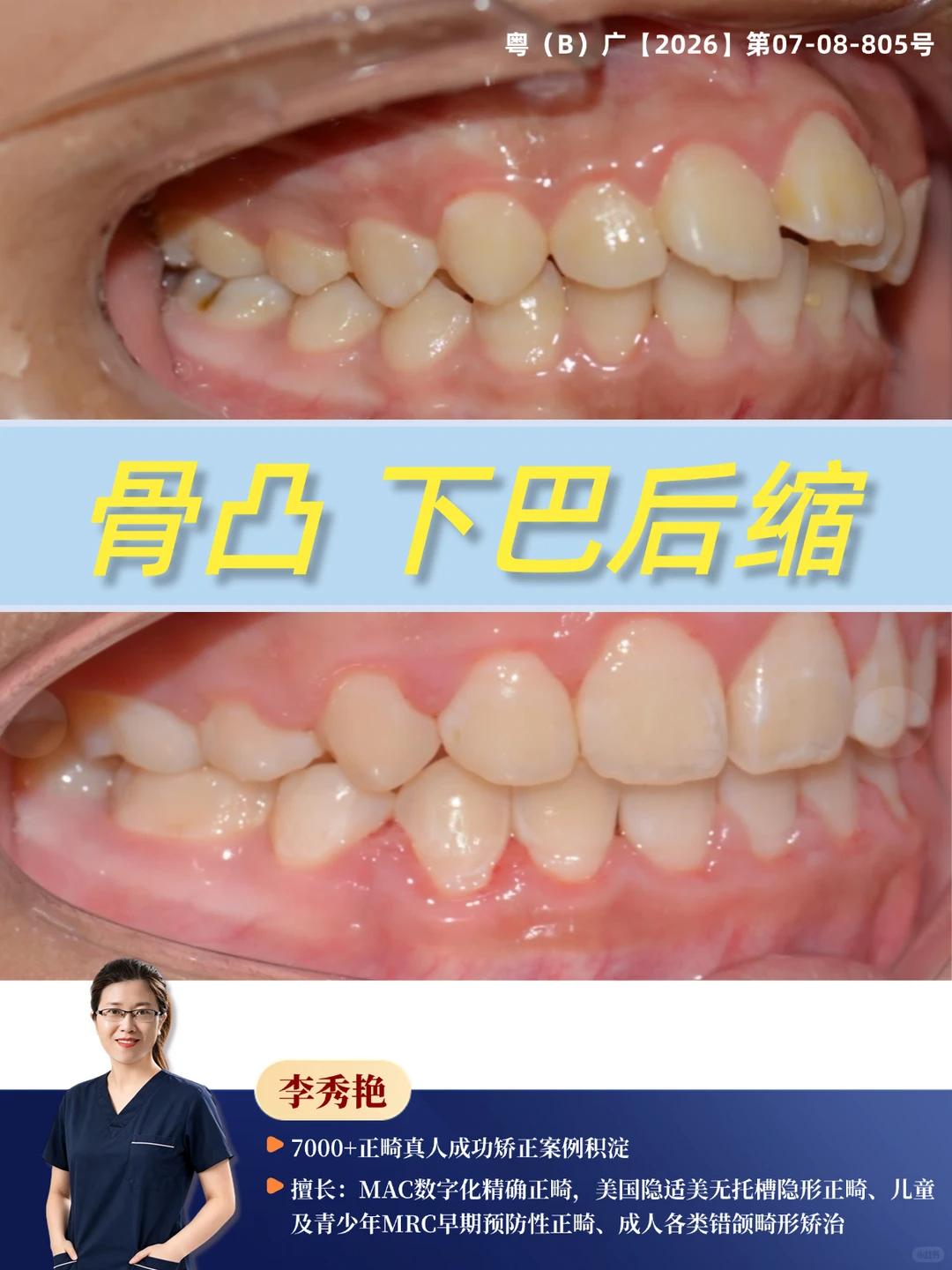 144c29ef-410d-46b9-a3a2-fc8aa544dd30.png