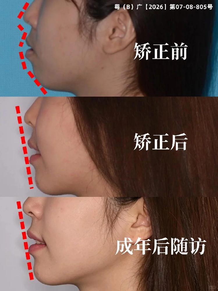 5185e2ce-5fdd-48d2-98fb-203e99f2b38c.png