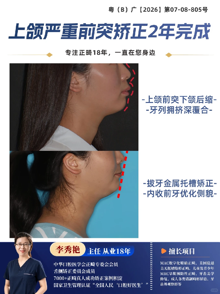 056f76de-f0b1-4abf-b544-55fe0bc908a3.png