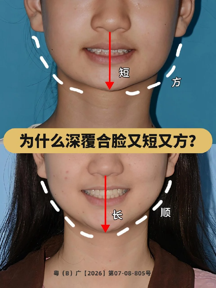 f8fa042e-0b77-4884-887a-b8eeefa42168.png