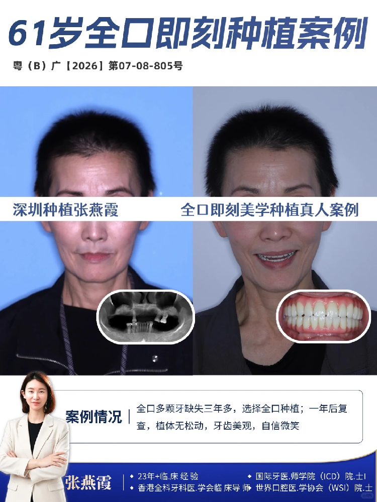 1793348449170624.png 93976138-f45b-4b77-b1a2-303d2bfaac7e.png