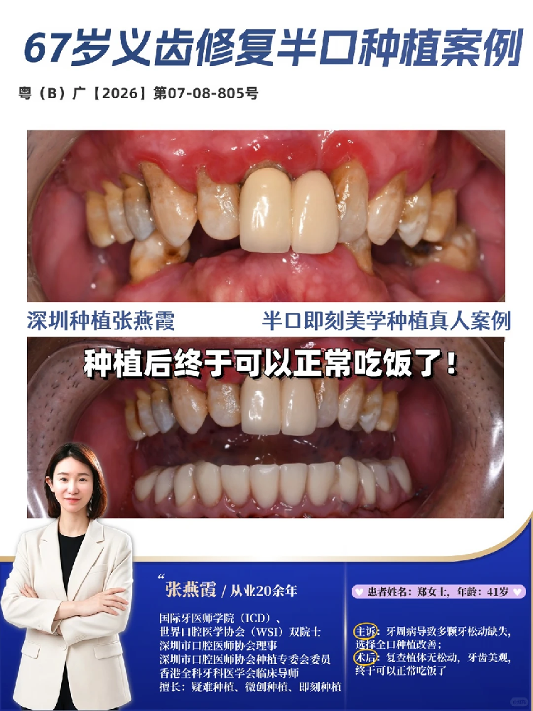 1793357752115807.png b360fb63-f090-49c9-80ca-445f0273d75c.png
