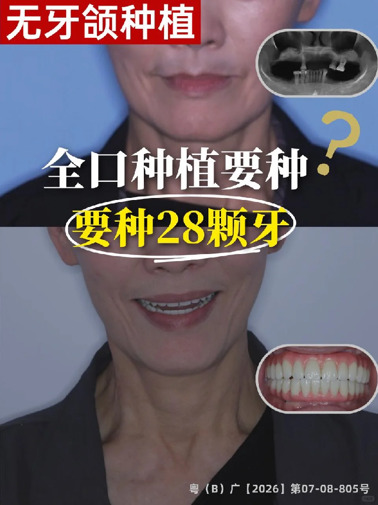 5f45fe98-96fe-4276-9e3d-85e2144c76d4.png