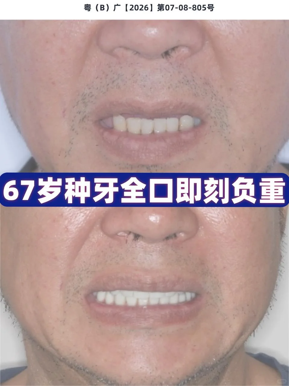 cc2f7a83-e318-4077-b3ac-22aee2caae4f.png