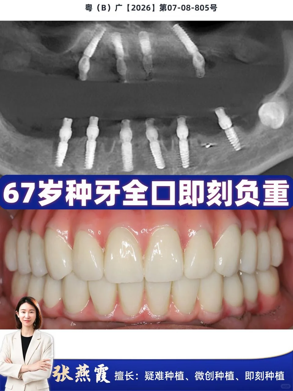 84b77e9b-b6cd-4bcd-a342-6ca32046f4b7.png