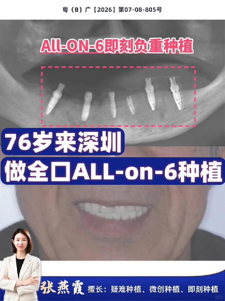 fc09b2f2-41df-4b5c-92d9-de51310e45a8.png
